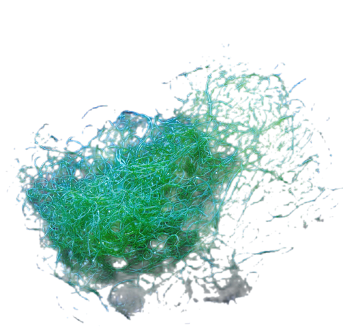 Chaetomorpha